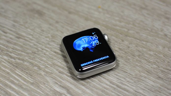Rozbité Apple Watch prešli reklamáciou. Nikdy sa nevzdávajte.