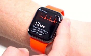Apple Watch EKG