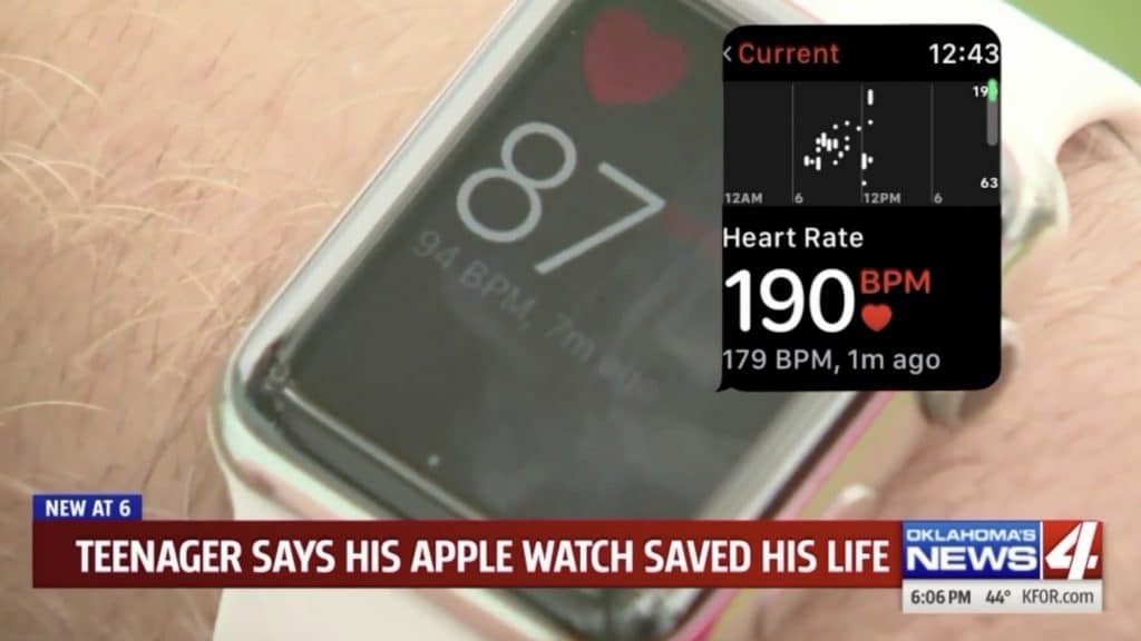 Apple Watch zachránili len 13 ročného chlapca. Jeho matka je dnes za ne vďačná.