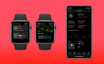 Apple Watch EKG