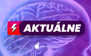 AKTUÁLNE mozgové čipy