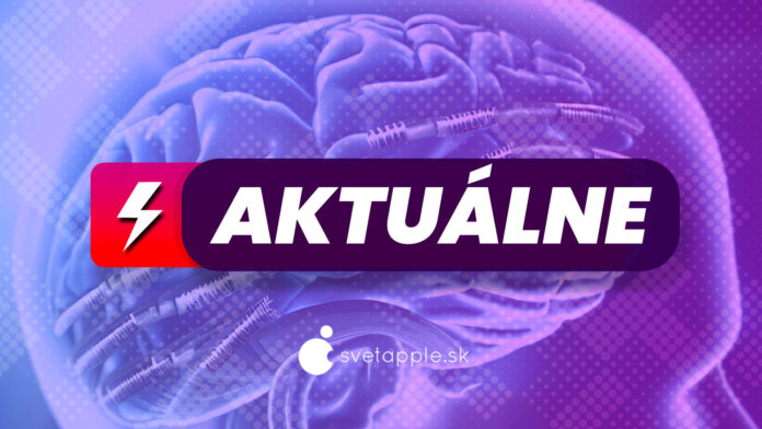 AKTUÁLNE mozgové čipy AKTUÁLNE mozgové čipy