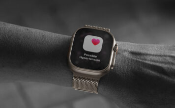 Apple Watch hypertenzia