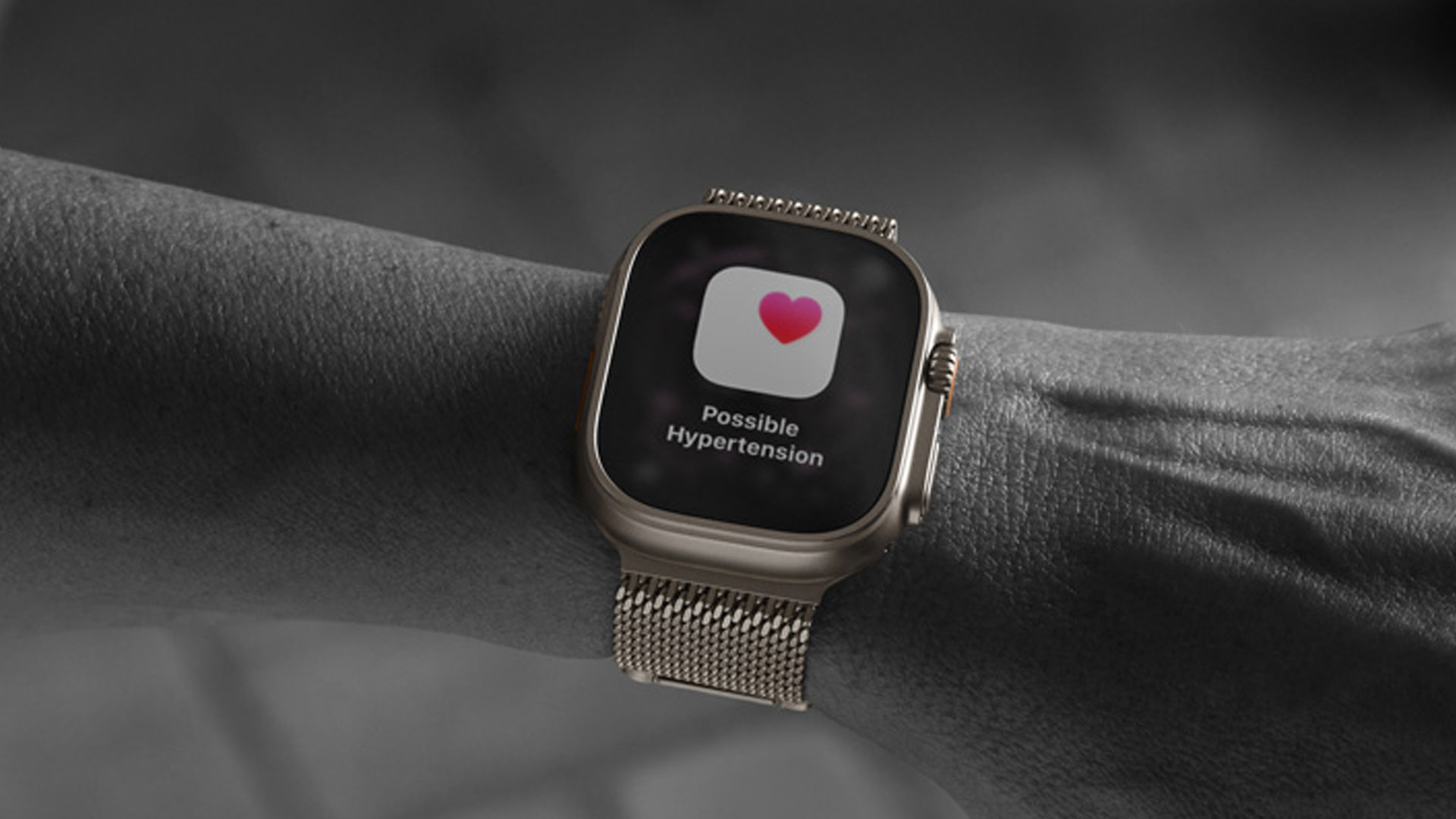 Apple Watch hypertenzia