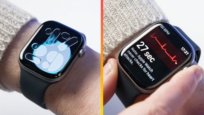 Apple Watch Series 11 Apple Watch Series 11