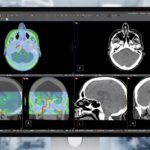 Monitor za 3,5 tisíca, ktorý vidí „pod kožu“: Apple Studio Display XDR mieri do nemocníc Apple Studio Display XDR DICOM