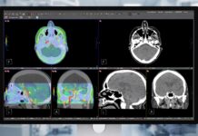 Monitor za 3,5 tisíca, ktorý vidí „pod kožu“: Apple Studio Display XDR mieri do nemocníc Apple Studio Display XDR DICOM