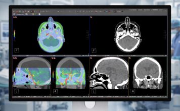 Monitor za 3,5 tisíca, ktorý vidí „pod kožu“: Apple Studio Display XDR mieri do nemocníc Apple Studio Display XDR DICOM