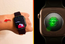 Nové Apple Watch majú NEPRÍJEMNÝ problém. Majitelia hlásia pálenie pokožky Apple Watch Series 12