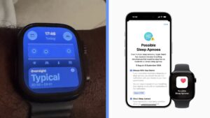 Apple Watch spánkové apnoe