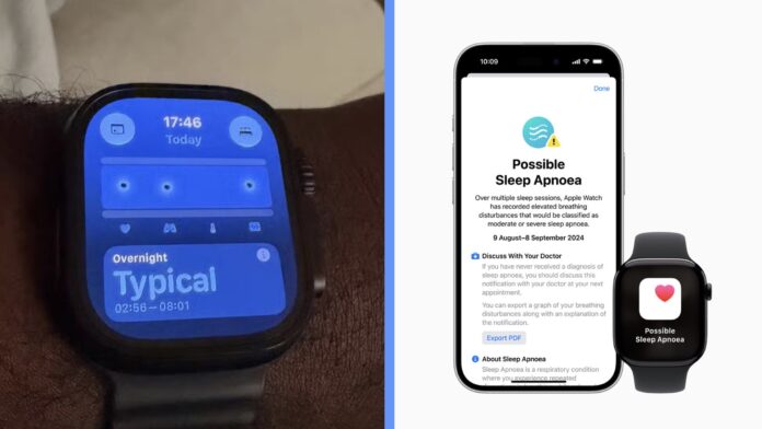 Apple Watch spánkové apnoe Apple Watch spánkové apnoe